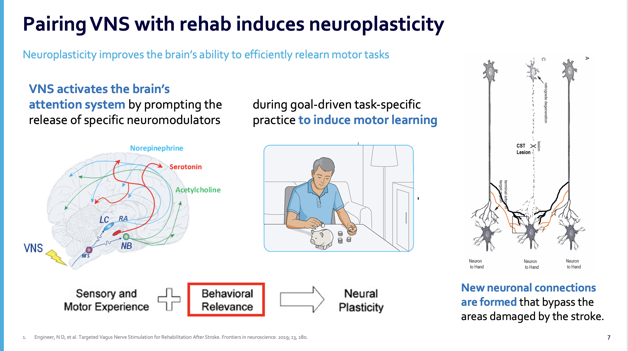 Implementing Paired VNS to Improve Motor Function for Chronic Stroke ...