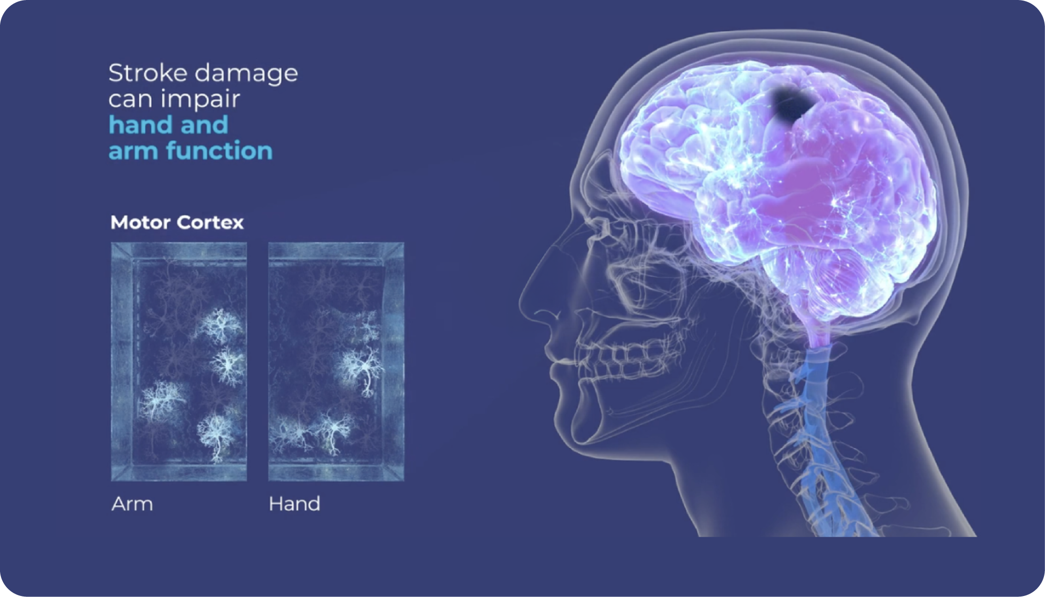 How Vivistim Works