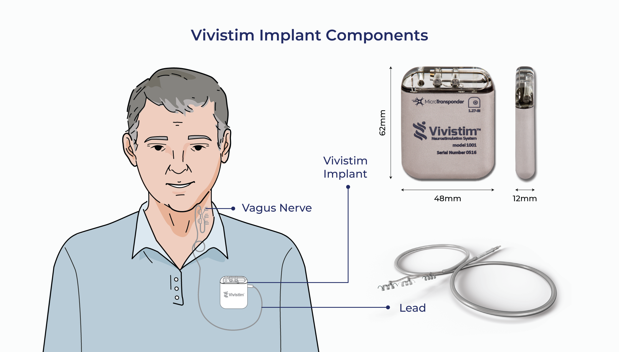 Illustration labeled 'Vivistim Implant Components' showing a person with a Vivistim implant near the chest, highlighting the vagus nerve, implant device, lead, and size measurements of the components.